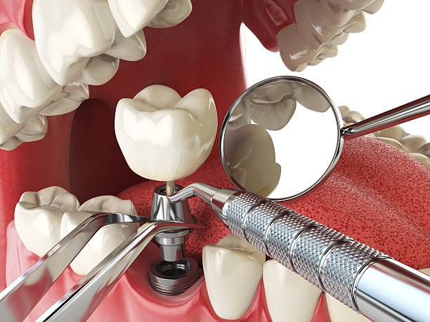 Best Emergency Treatment for Dental Infections or Abscesses in Franklin Farm, VA